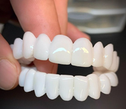 DentAlign | Profesjonalna protetyka stomatologiczna dla przywrócenia naturalnego uśmiechu 0