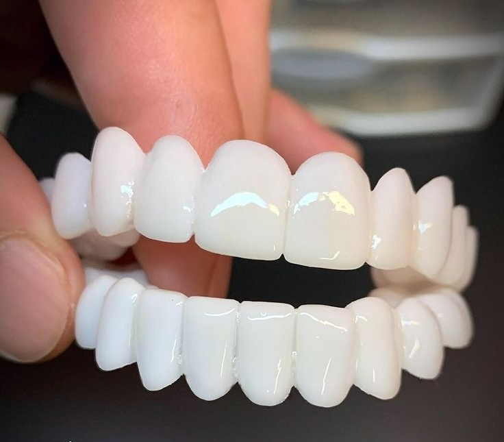 DentAlign | Profesjonalna protetyka stomatologiczna dla przywrócenia naturalnego uśmiechu 0