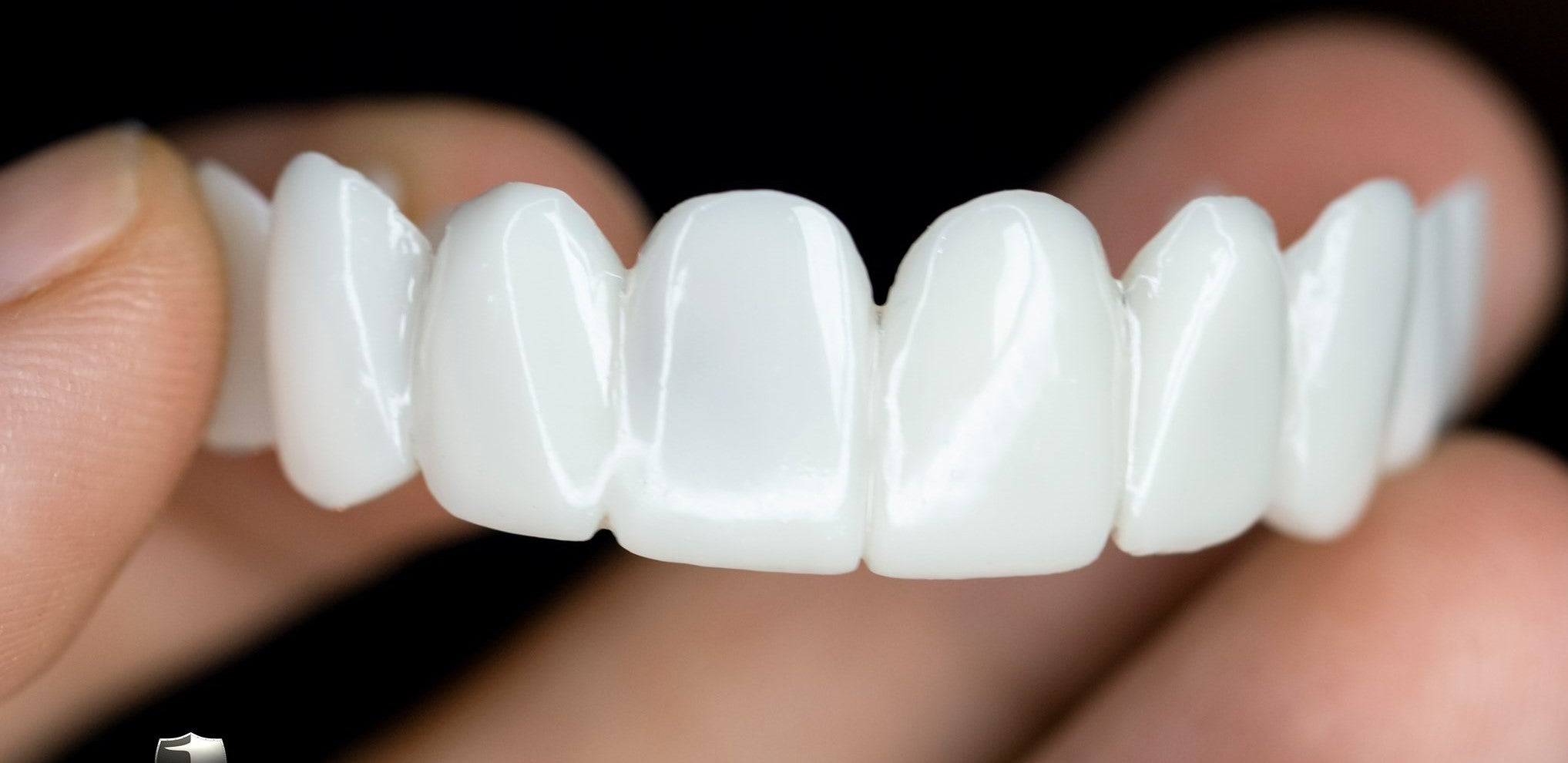 DentAlign | Profesjonalna protetyka stomatologiczna dla przywrócenia naturalnego uśmiechu 3