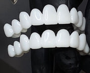DentAlign | Profesjonalna protetyka stomatologiczna dla przywrócenia naturalnego uśmiechu 4
