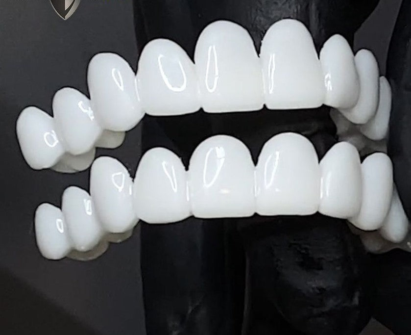 DentAlign | Profesjonalna protetyka stomatologiczna dla przywrócenia naturalnego uśmiechu 4