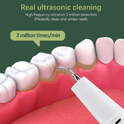 Dentora | Profesjonalny ultradźwiękowy środek do usuwania kamienia nazębnego, łatwy w czyszczeniu w domu 3
