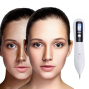 Laser plazmowy Clearskinpro – nieinwazyjny | Do usuwania piegów, narośli skórnych, plam, znamion i tatuaży w domu 3