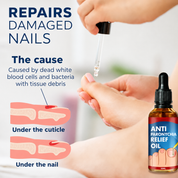 Reparatur beschädigter Nägel | Eingewachsene Nägel & Nagelbett | Hände & Füße | KeraSeal 1